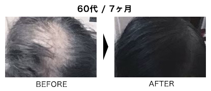 驚異の発毛率 MONNALI モナリ | 茨木・高槻の美容室アカンサス